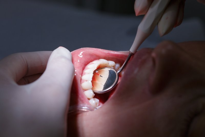a person having their teeth and gums checked