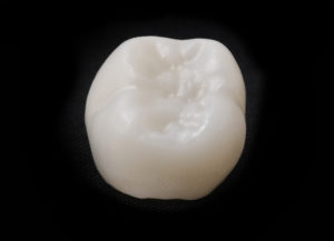 dental crown